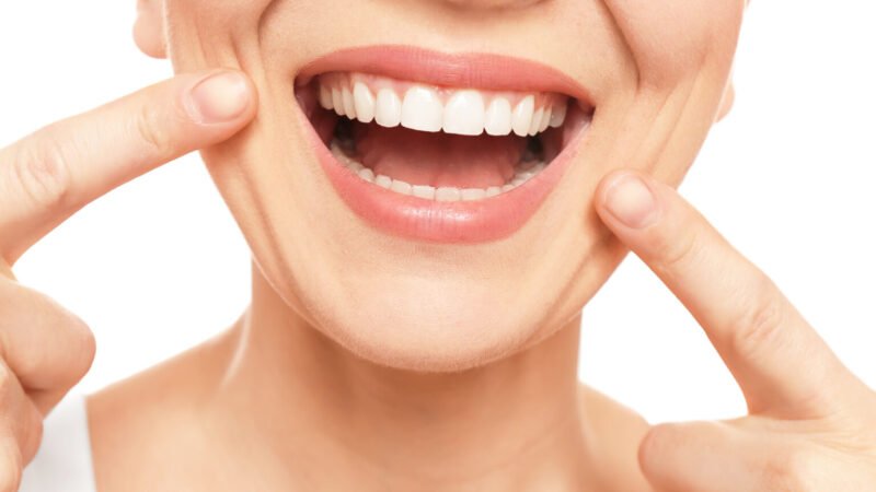 7 Health Benefits of Having Perfectly Straight Teeth