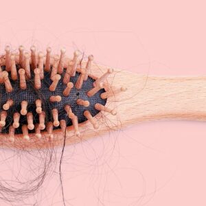 Different Stages of Hair Loss and How to Cope with Them